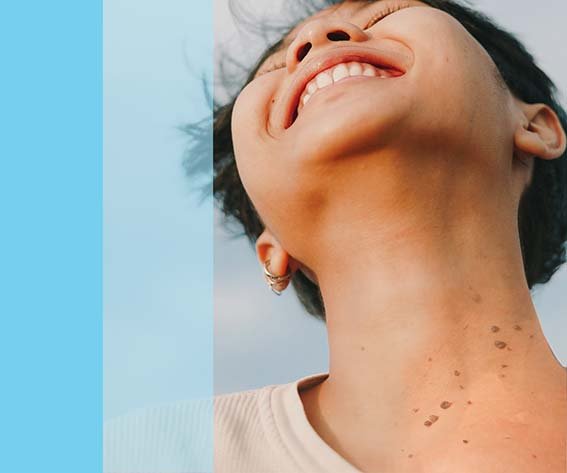 Skin Tags Removal