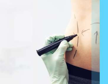 Body Contouring